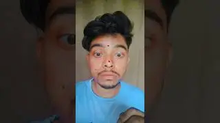 What kind of disease is this? 😛#shorts #shortsfeed #youtubeshorts