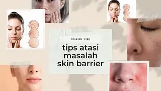 Tips atasi masalah skin barrier