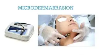 Best facial glow/ tan removal procedure in visakhapatnam- Microdermabrasion