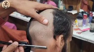 Pimple Remove 🌟HeadShave Tutorial for Men's 2025 Change looking so Amazing in AliHairDresser 💈