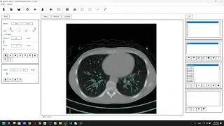 Reform 1.3v - DICOM Segmentation