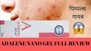 ADALENE NANO GEL FULL REVIEW BEST ANTI ACNE GEL