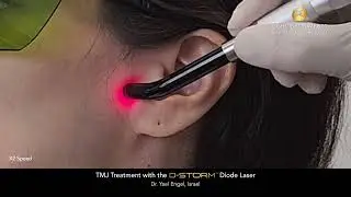 TMJ Treatment with the D-Storm&trade; Diode Laser