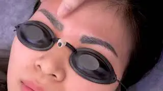 Xóa xăm bằng Laser có an toàn và hiệu quả không?