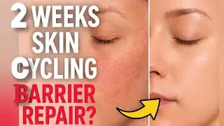 My 2‑Week Skin Cycling Experiment | Barrier Repair ya Damage? #skincare #beauty@Beautywithdriqra