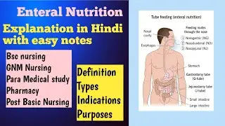 Enteral Nutrition(Difference between Enternal Nutrition and Parenteral Nutrition) Full explanation