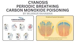 Cyanosis, Periodic Breathing & Carbon Monoxide Poisoning | Respiratory Disorders Explained