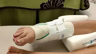 she has a sprain ankle and put brace on it
