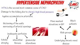 CoMICs Episode 40: Hypertensive Nephropathy