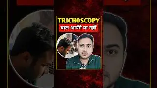 My Trichoscopy Experience | Hair Fall Treatment