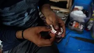India's street dentists filling gap for the poor