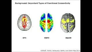 OHBM 2018 | Educational Course | Brain Parcellations and Functional Territories | Part 3