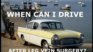 When Can I Drive After Leg Vein Treatment?