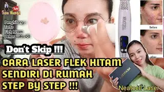 LASER BLACK SPOT REMOVAL AT HOME || NEATCELL LASER || CARA MENGHILANGKAN FLEK HITAM DENGAN LASER