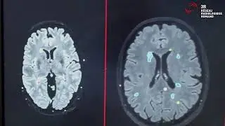 Pixyl.Neuro presentation by 3R - part 1