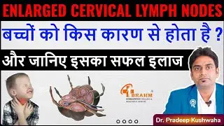 Enlarged cervical lymph nodes treatment |  Cervical lymph nodes in child | lymphadenitis