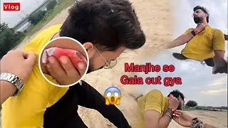 Blood nikal gya😨 Mere Uper Prank Kr Diya Nikhil ne🥲