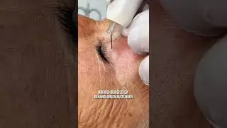 JOVENA - PlasmaPro im Detail