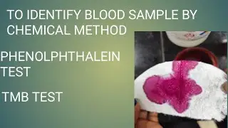 To identify blood samples by chemical test #forensicscience #bloodsample #serology #virlvideo 
