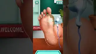 foot surgery level 1 #footgame #shorts #short