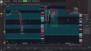 (+$568 50K Eval Day Trading TopStep X Amazing Setups Got Scared 2nd Trade of Giving Back Profits :(
