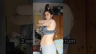 2 weeks postpartum belly shot #shorts #postpartum