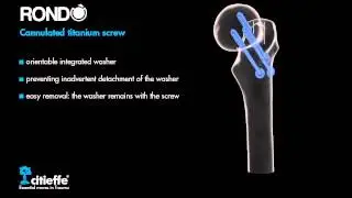 Citieffe - Rond&ograve; cannulated titanium screw