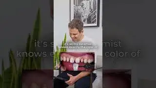 💫 Perfect Smile: Gum Reshaping & Porcelain Veneers 🦷✨
