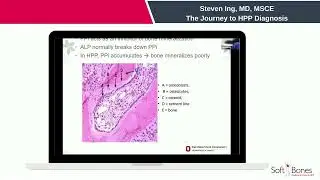 The Journey to HPP Diagnosis
