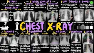 Chest X-Ray Interpretation | Clinical Skills 03 | Clinical Essentials | PPNotes