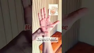 #shortsvideo Best Exercise for Carpal Tunnel Relief in 1 Minute Wrist Pain &Numbness Fix #wristpain