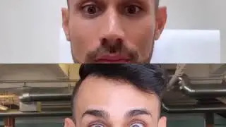 Botox won't freeze your face