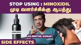 STOP🔴Dont use Minoxidil : மினாக்ஸிடில் உண்மை முகம் | Creas Cosmetic Center | Coimbatore