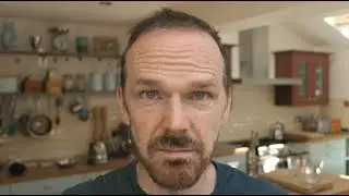 HAIR TRANSPLANT DYE AND GRADE 4 HAIR CUT