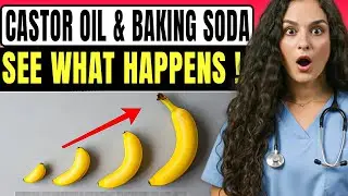 Urologist: Mix Castor Oil With Baking Soda & Apply It For 10 Mins&nbsp;- See What Happens