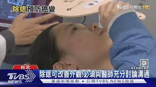 注意!除痣之前疏忽「這件事」....醫師:死亡風險增 不可輕忽!..............｜十點不一樣20250213 @TVBSNEWS02