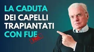 La caduta dei capelli trapiantati con la tecnica FUE