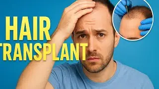 Hair transplant: What Men Must Know Before Surgery