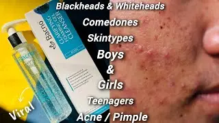 Best acne face wash | bacno cleanser | ance treatment | Facewash for acne and pimple| face wash best