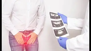 prostagenius blej kosov&euml;n