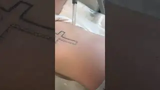 #laser #tattoo #tattooremoval #lasertattooremoval