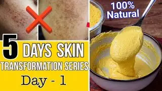 Skin Transformation Challenge (Day1) : 5 Days Skin Ritual for a Healthy, Glowing & Flawless Skin