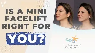 Mini or Full Facelift? How Plastic Surgeons Choose What&rsquo;s Best for Your Face