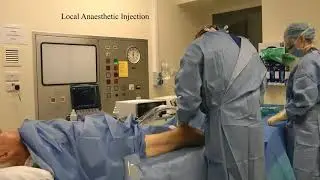 Endovenous Laser ablation  treatment for varicose veins (EVLA) in Bournemouth and Poole