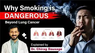 Why Smoking is Dangerous Beyond Lung Cancer | Explained by Dr. Chirag Dausage