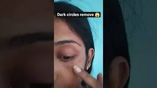 i find the solution for dark circles under the budget 😱#brightskin #shortvideo #beauty #dark circles