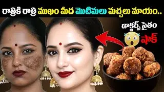బెల్లంలో ఈ ఒక్కటి కలిపి రాస్తే చాలు, ముఖం మీద మొటిమలు మచ్చలు మాయం || Jaggery  Uses For Pigmentation