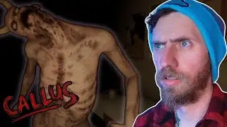 MOMMA SAID I&rsquo;D BE SAFE HERE | CALLUS [Full Game] (Let&rsquo;s Play)