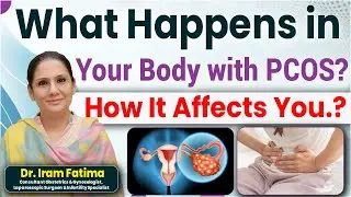 What is PCOS and Bilateral Polycystic Ovaries | Awareness and Lifestyle Tips | Ankura Hospital