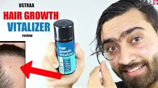 USTRAA HAIR GROWTH VITALIZER REVIEW | HOW TO USE, BENEFITS, RESULTS | QUALITYMANTRA